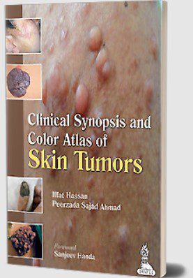 Clinical Synopsis and Color Atlas of Skin Tumors by Iffat Hassan PDF Free Download