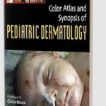 Color Atlas and Synopsis of Pediatric Dermatology by Sandipan Dhar PDF Free Download