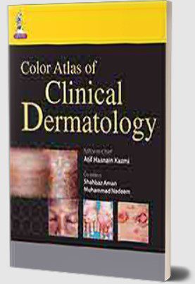 Color Atlas of Clinical Dermatology by Atif Hasnain Kazmi PDF Free Download