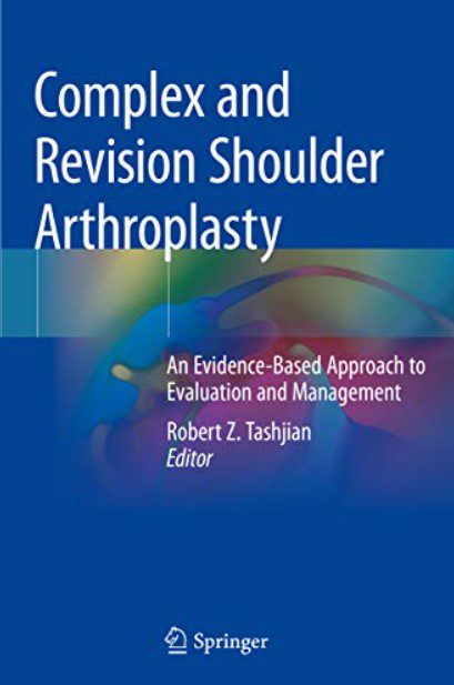 Complex and Revision Shoulder Arthroplasty PDF Free Download