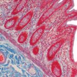 Current Topics in Gastrointestinal and Liver Pathology 2022 Videos Free Download