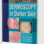 Dermoscopy in Darker Skin by Manas Chatterjee PDF Free Download