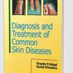Diagnosis and Treatment of Common Skin Diseases by Govind Srivastava PDF Free Download