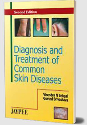 Diagnosis and Treatment of Common Skin Diseases by Govind Srivastava PDF Free Download