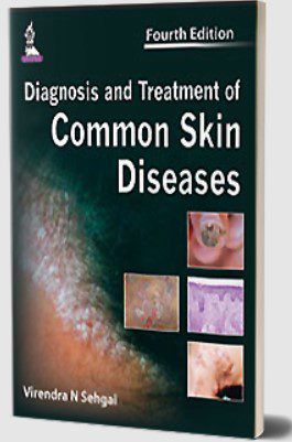 Diagnosis and Treatment of Common Skin Diseases by Virendra N Sehgal PDF Free Download
