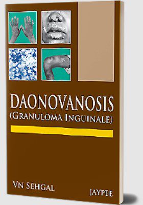 Donovanosis (Granuloma Inguinale) by Virendra N Sehgal PDF Free Download
