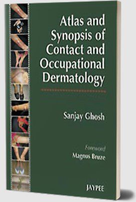 Download Atlas and Synopsis of Contact and Occupational Dermatology by Sanjay Ghosh PDF Free