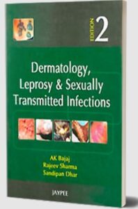 Download Dermatology, Leprosy and Sexually Transmitted Infections by Rajeev Sharma PDF Free