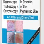 Download Dermoscopy, Trichoscopy and Onychoscopy in Diseases of the Pigmented Skin: An Atlas and Short Text PDF Free