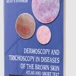 Download Dermoscopy and Trichoscopy in Diseases of the Brown Skin: Atlas and Short Text PDF Free