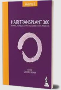 Download Hair Transplant 360 (Advances, Techniques, Business Development & Global Perspectives), Volume 3 PDF Free