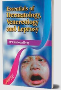 Essential of Dermatology, Venereology and Leprosy by SP Chattopadhyay PDF Free Download