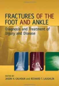 Fractures of the Foot and Ankle: Diagnosis PDF Free Download