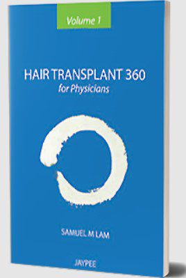 Hair Transplant 360 (For Physicians), Volume 1 by Samuel M Lam PDF Free Download