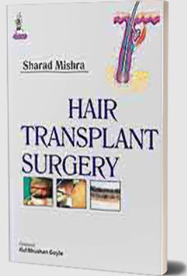 Hair Transplant Surgery by Sharad Mishra PDF Free Download