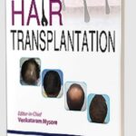 Hair Transplantation by Venkataram Mysore PDF Free Download