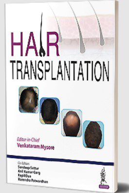 Hair Transplantation by Venkataram Mysore PDF Free Download