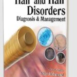 Hair and Hair Disorders: Diagnosis & Management by S Sacchidanand PDF Free Download