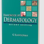 Handbook of Dermatology by G Ilangovan PDF Free Download