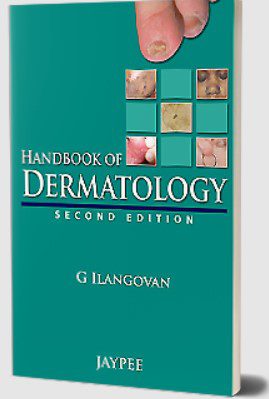 Handbook of Dermatology by G Ilangovan PDF Free Download