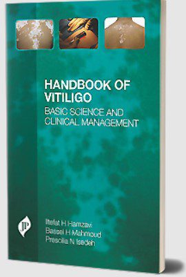 Handbook of Vitiligo: Basic Science and Clinical Management PDF Free Download