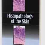 Histopathology of the Skin by Ashok Aggarwal PDF Free Download
