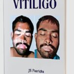 How to Cure a Skin Disease: Vitiligo by JS Pasricha PDF Free Download