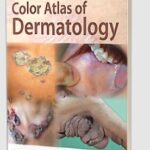 IADVL Color Atlas of Dermatology by Manas Chatterjee PDF Free Download