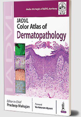 IADVL Color Atlas of Dermatopathology by Pradeep Mahajan PDF Free Download