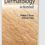 Management of Dermatology in Nutshell by Ranjan C Raval PDF Free Download