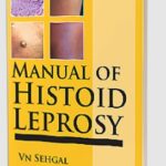 Manual of Histoid Leprosy by Govind Srivastava PDF Free Download