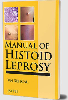 Manual of Histoid Leprosy by Govind Srivastava PDF Free Download