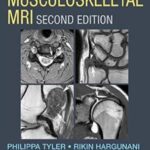Musculoskeletal MRI 2nd Edition PDF Free Download