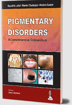 Pigmentary Disorders: A Comprehensive Compendium by Rashmi Sarkar PDF Free Download