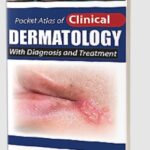 Pocket Atlas of Clinical Dermatology with Diagnosis and Treatment PDF Free Download