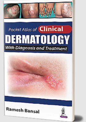 Pocket Atlas of Clinical Dermatology with Diagnosis and Treatment PDF Free Download