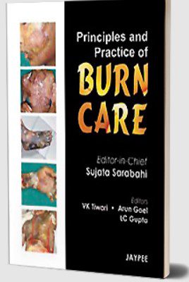 Principles and Practice of Burn Care by LC Gupta PDF Free Download