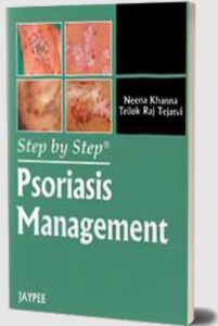 Psoriasis Management by Neena Khanna PDF Free Download