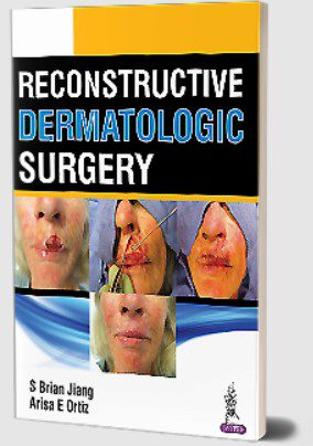 Reconstructive Dermatologic Surgery by S Brian Jiang PDF Free Download