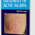 Treatment of Acne Scars by Niti Khunger PDF Free Download