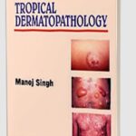 Tropical Dermatopathology by Manoj Singh PDF Free Download