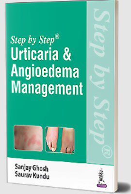Urticaria & Angioedema Management by Sanjay Ghosh PDF Free Download