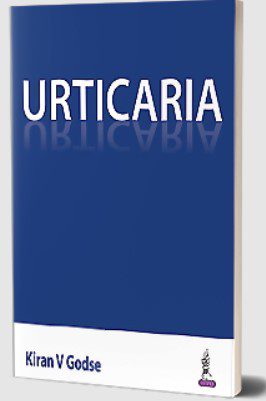 Urticaria by Kiran V Godse PDF Free Download