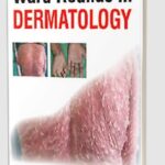 Ward Rounds in Dermatology by Bela J Shah PDF Free Download