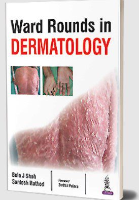 Ward Rounds in Dermatology by Bela J Shah PDF Free Download