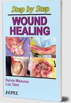 Wound Healing by Sylvie Meaume PDF Free Download
