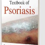 A Comprehensive Textbook of Psoriasis by Iffat Hassan PDF Free Download