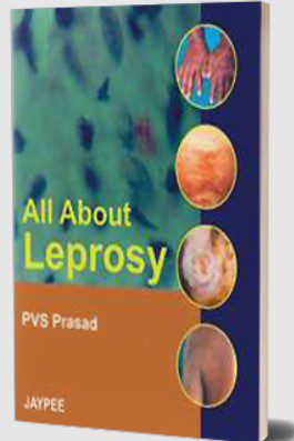 All about Leprosy by PVS Prasad PDF Free Download