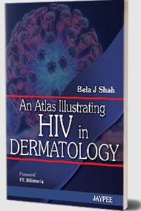An Atlas Illustrating HIV in Dermatology by Bela J Shah PDF Free Download