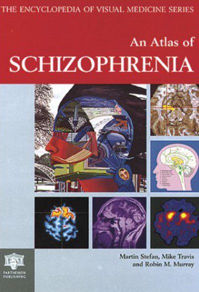 Atlas of Schizophrenia PDF Free Download